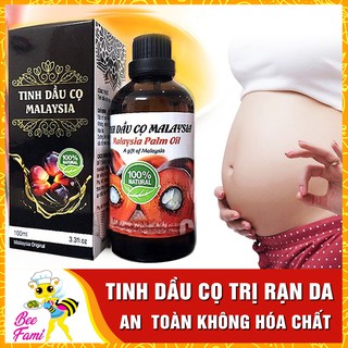 Tinh Dầu Cọ Malaysia Trị Rạn Da Cho Mẹ 100ml
