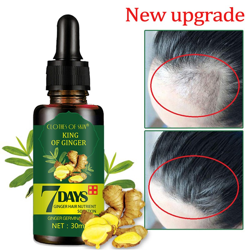 [Hàng mới về] Serum dưỡng kích thích mọc tóc tinh chất gừng tự nhiên dưỡng chân tóc khỏe mạnh