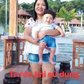 Kem ủ tiêu mỡ trương gia hân dùng cho cả nam và nữ