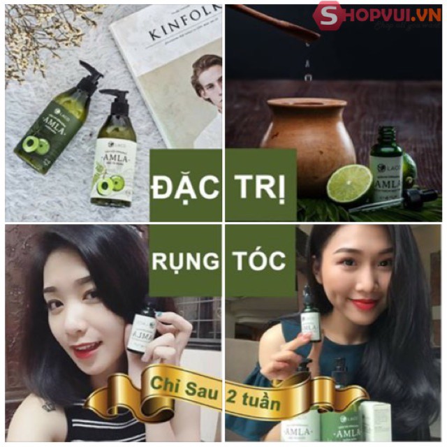 Bộ 3 Sản Phẩm Dầu Gội - Xả - Serum Ngăn Ngừa Rụng Tóc Amla | BigBuy360 - bigbuy360.vn