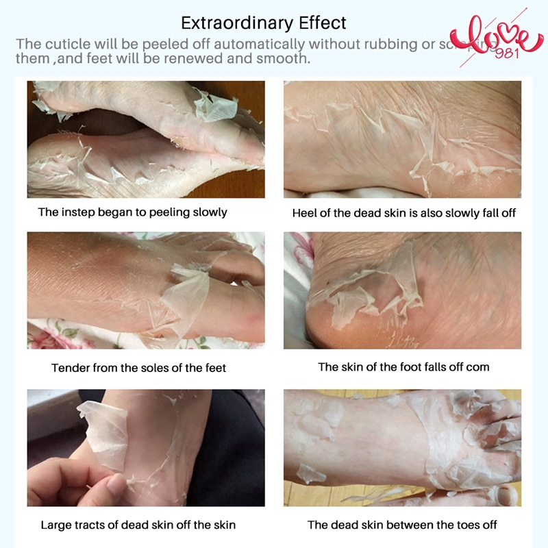 Mặt nạ bàn chân tẩy da chết với chiết xuất hoa oải hương dưỡng ẩm và làm trắng da