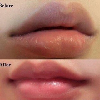 Tẩy Tế Bào Chết Môi