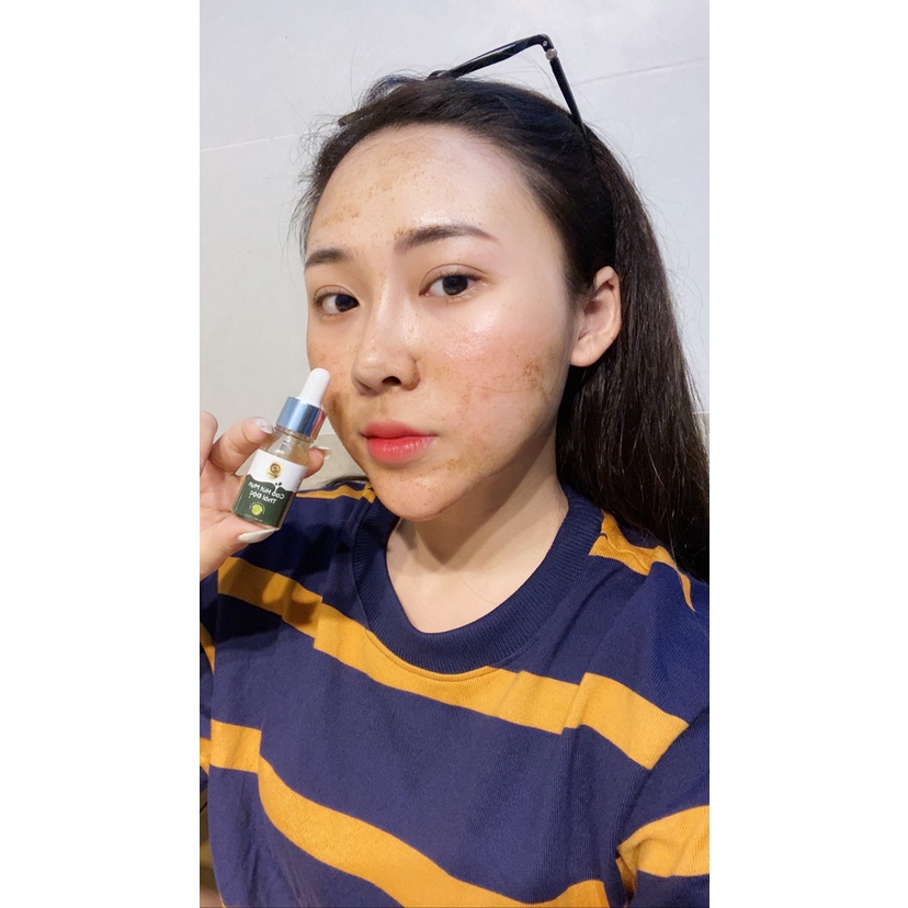 Cao hút mụn thải độc, detox da, mua 1 tặng 1