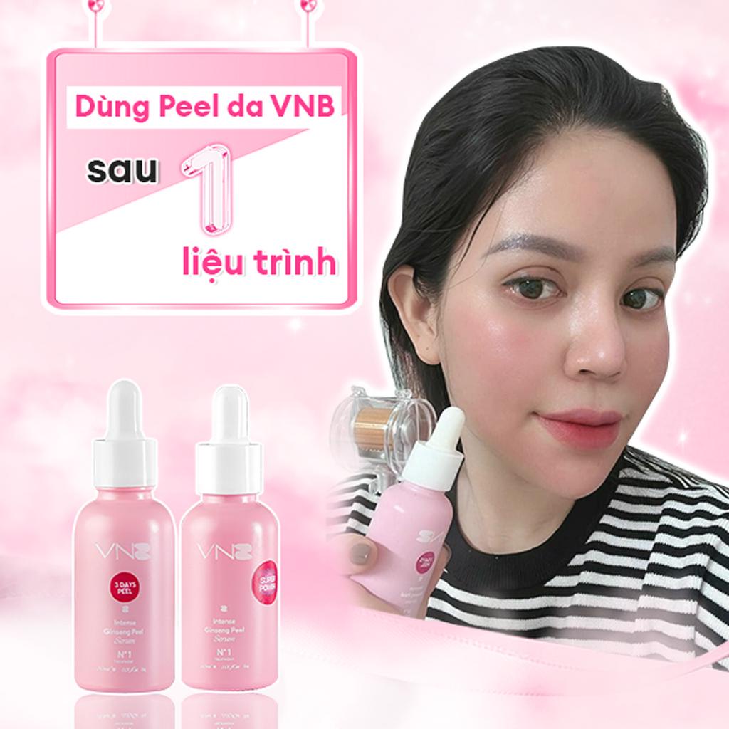 Serum Peel Da 3 Day VNB Chính Hãng Intense Ginseng - Tinh chất Peel Da Giảm Mụn Thâm Nám