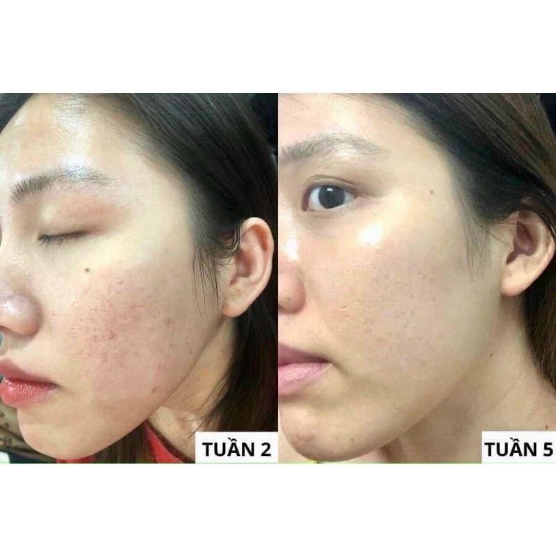 Tuýp 30ml Retinol Repair phục hồi da không gây bong tróc ,tái tạo trẻ hoá da