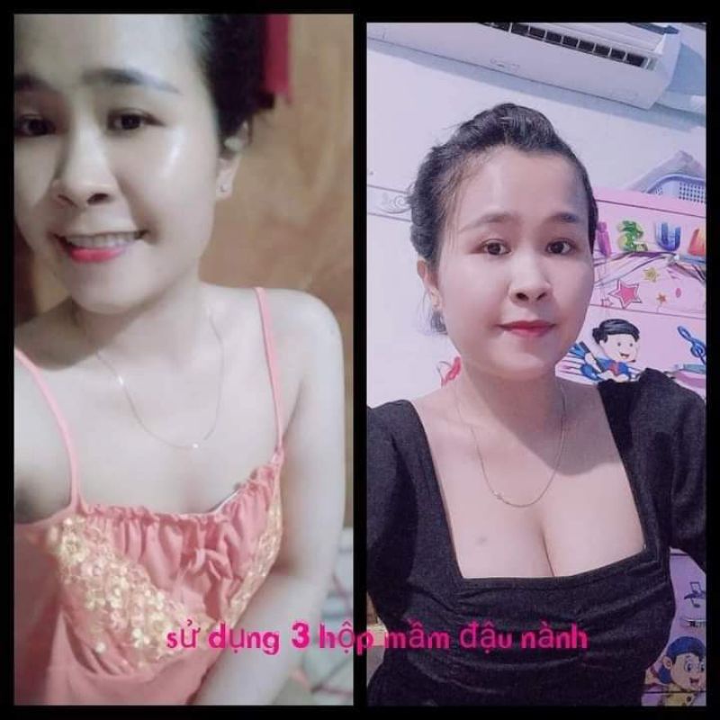 COMBO TĂNG VÒNG 1 CẤP TỐC MỊ HƯƠNG HÀNG CHÍNH HÃNG