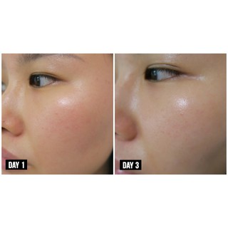 [Quinshop.vn] Tinh Chất Nhân Sâm I'm From Ginseng Serum