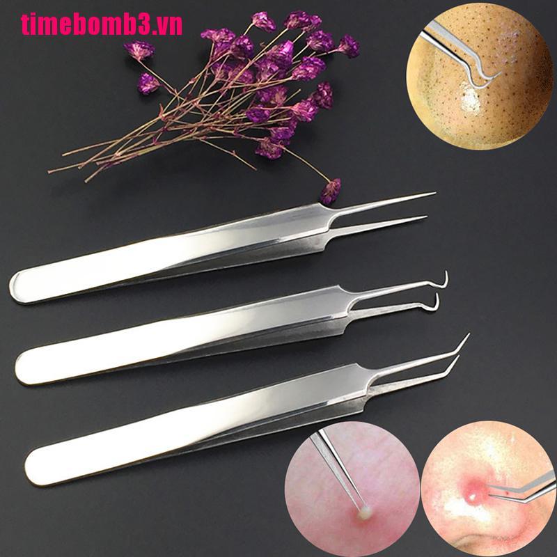 (Hàng Mới Về) Nhíp Nặn Mụn Đầu Đen Bằng Thép Không Gỉ Tiện Dụng | BigBuy360 - bigbuy360.vn