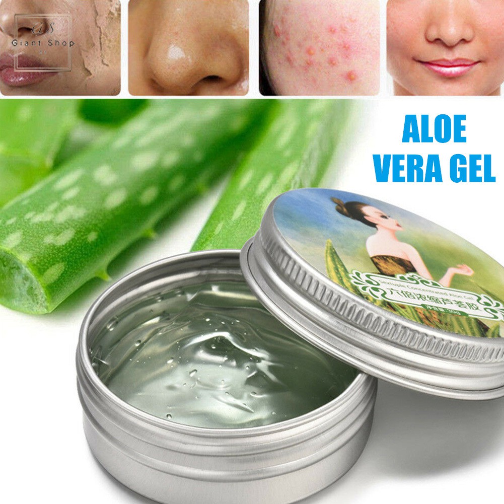 (Hàng Mới Về) Gel Lô Hội Dưỡng Ẩm Trị Mụn Và Làm Dịu Da