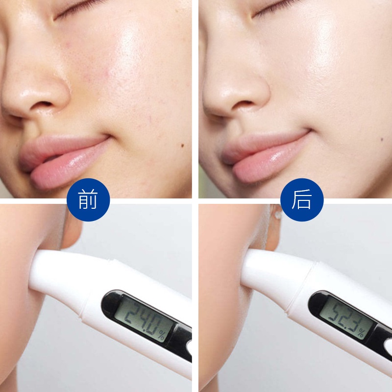 Hộp 5 Mặt nạ HA LÀM SẠCH SÂU DƯỠNG TRẮNG CHỐNG LÃO HÓA nội địa Trung