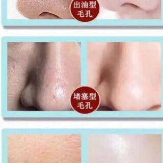 Tinh chất dưỡng shrinkage pore