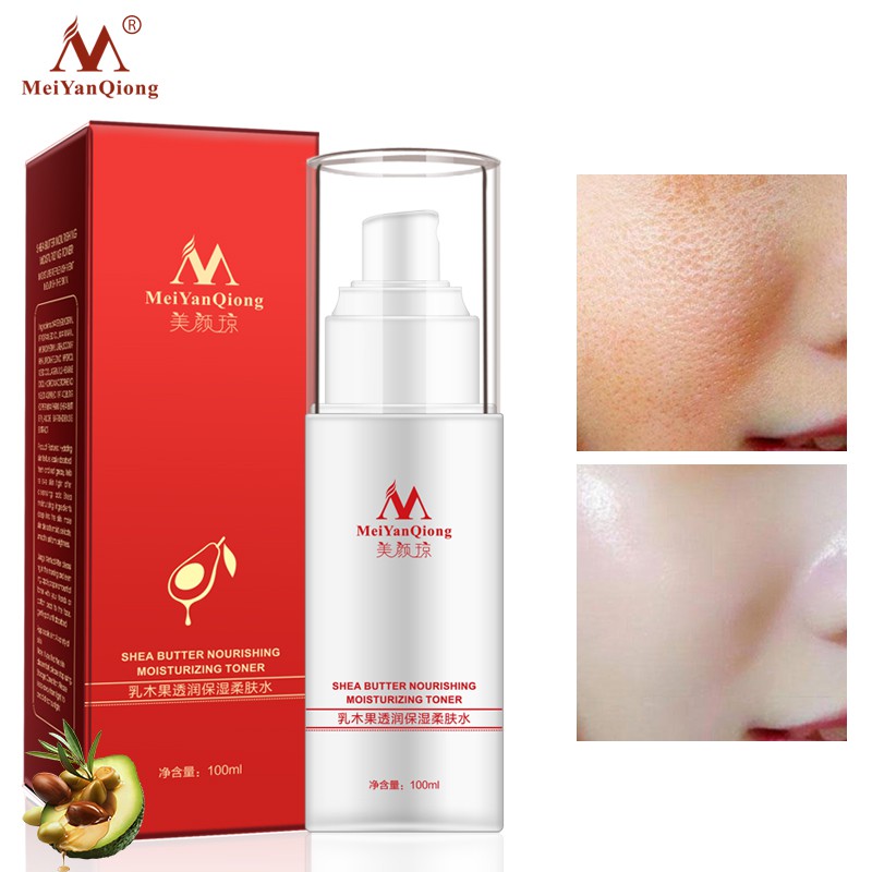 Nước Hoa Hồng MeiYanQiong Tinh Chất Bơ Hạt Mỡ Axit Hyaluronic Dưỡng Ẩm Làm Trắng Da 100ml