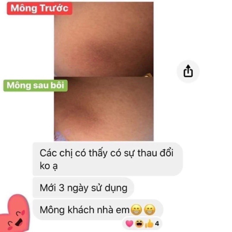 Siêu Dưỡng Thâm 5S BihoLadi Đánh Bay Thâm Nách, Thâm Mông, Bikini, Giúp Trắng Da, Mịn Da (Biho_Ladi, Biho_Lady) | BigBuy360 - bigbuy360.vn