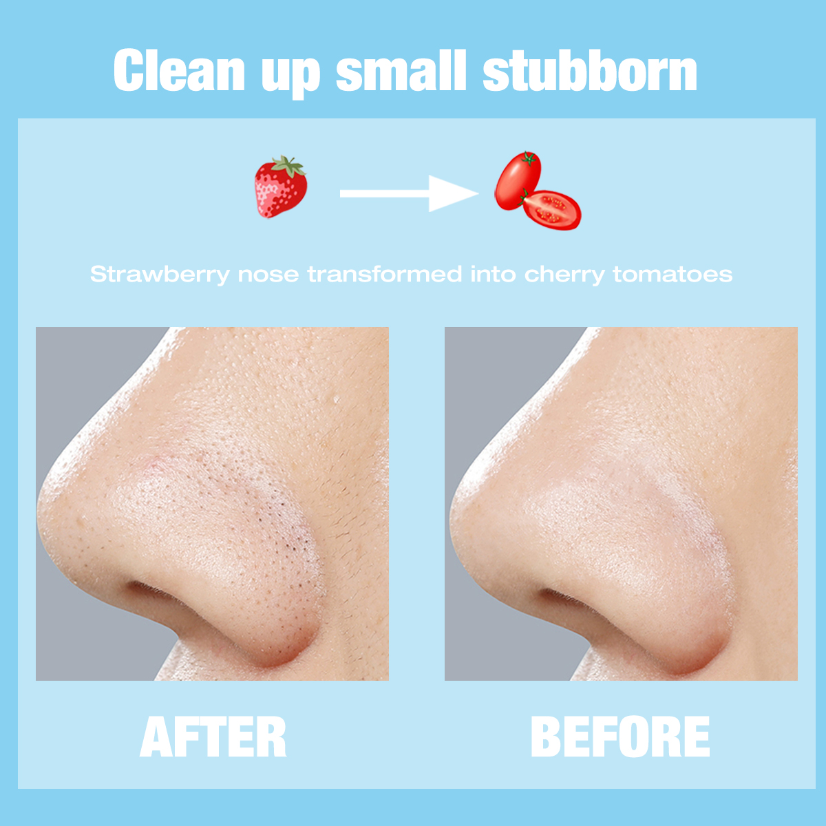 Miếng Dán Lột Mụn Đầu Đen LAMUSELAND LA8001 Làm Sạch Sâu Lỗ Chân Lông Vùng Mũi | BigBuy360 - bigbuy360.vn