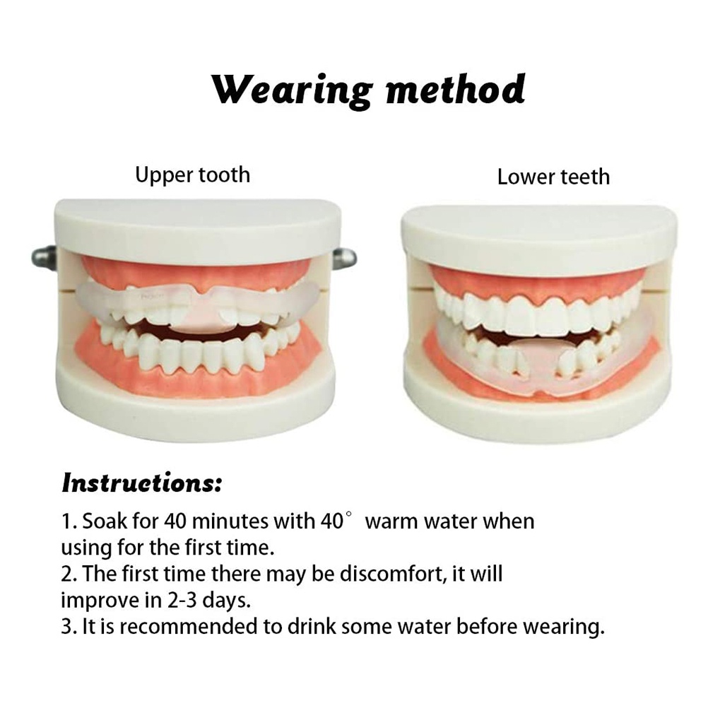 [Hàng mới về] Dụng cụ bảo vệ răng ban đêm chống nghiến tiện lợi