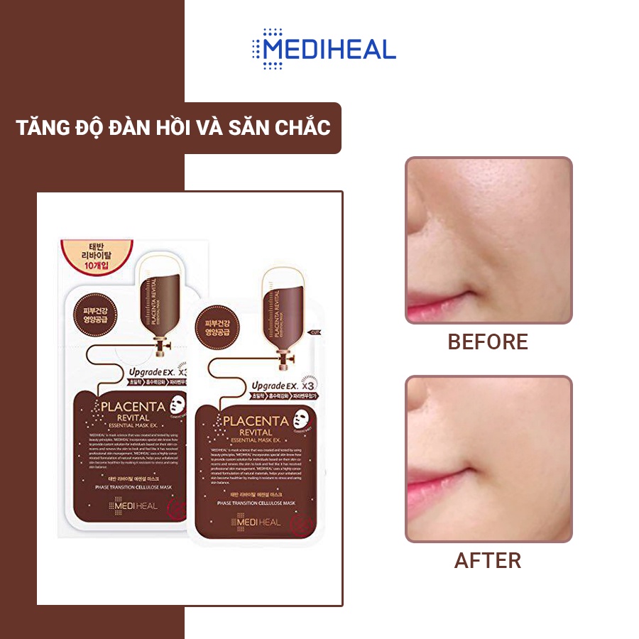 Mặt Nạ Nhau Thai Cừu Phục Hồi Da Mediheal Placenta Revital Essential Mask Ex 24ml [K2]