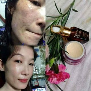 Kem face n collagen