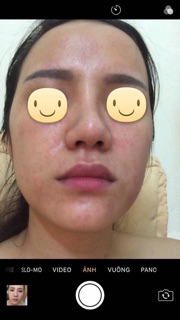 Bột xông thiên nhiên thải độc da