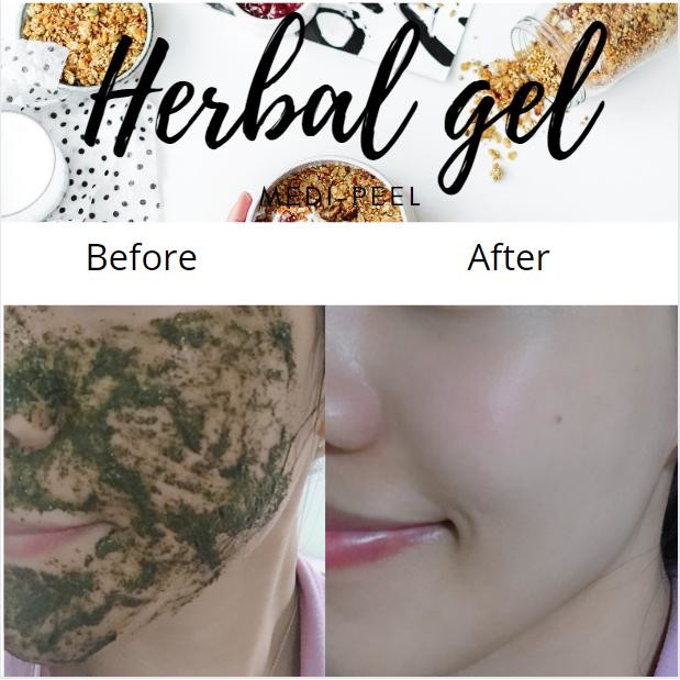 HERBAL PEEL TOX Mặt Nạ Ủ Trắng Da Và Tẩy Tế Bào Chết