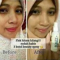 ! Chai Xịt Làm Đẹp Code-770 Natura Nguyên Bản 100% | BigBuy360 - bigbuy360.vn