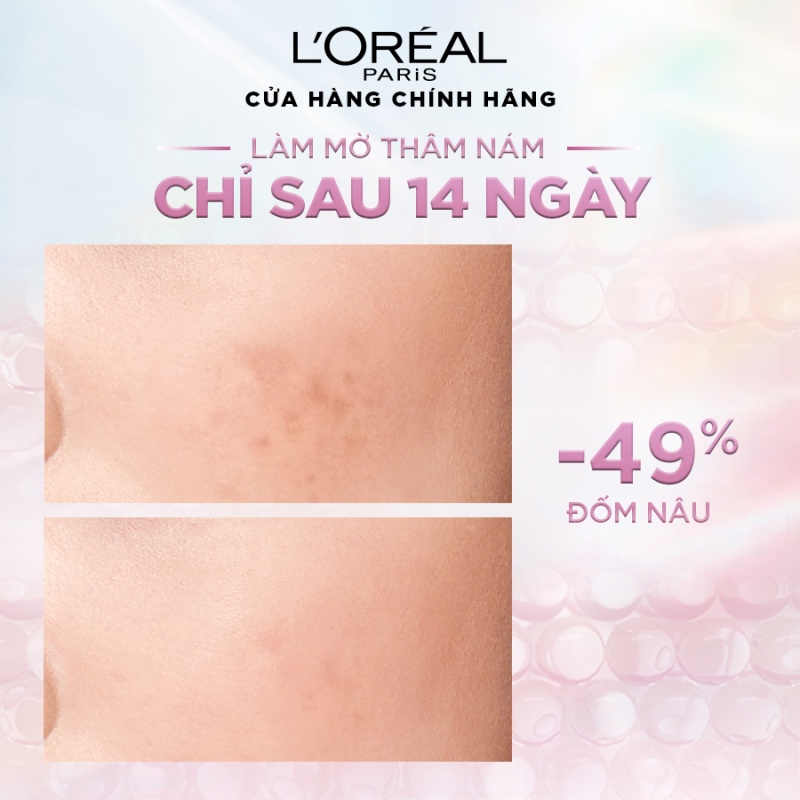 Bộ Serum &amp; Kem đêm sáng da tức thì Glycolic Bright L'Oreal Paris 15ml