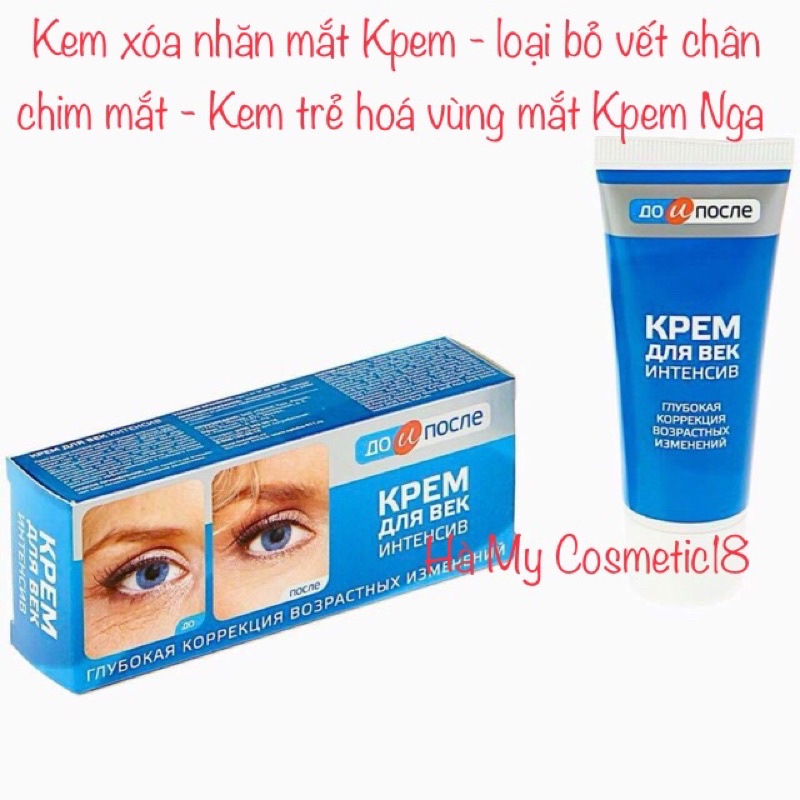 Kem xóa nhăn mắt Kpem - loại bỏ vết chân chim mắt - Kem trẻ hoá vùng mắt Kpem Nga