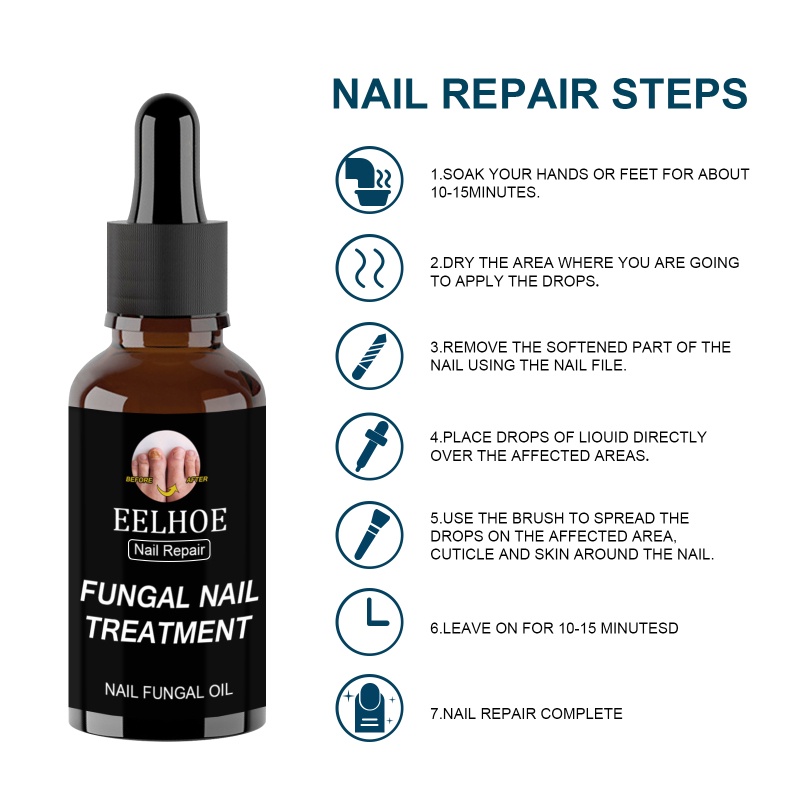 Eelhoe Nail Repair Serum Chân Sửa Chữa Tinh Chất Gel Loại Bỏ Nấm Sơn Móng Tay 30Ml/50Ml Sản Phẩm Chăm Sóc Móng Wine01