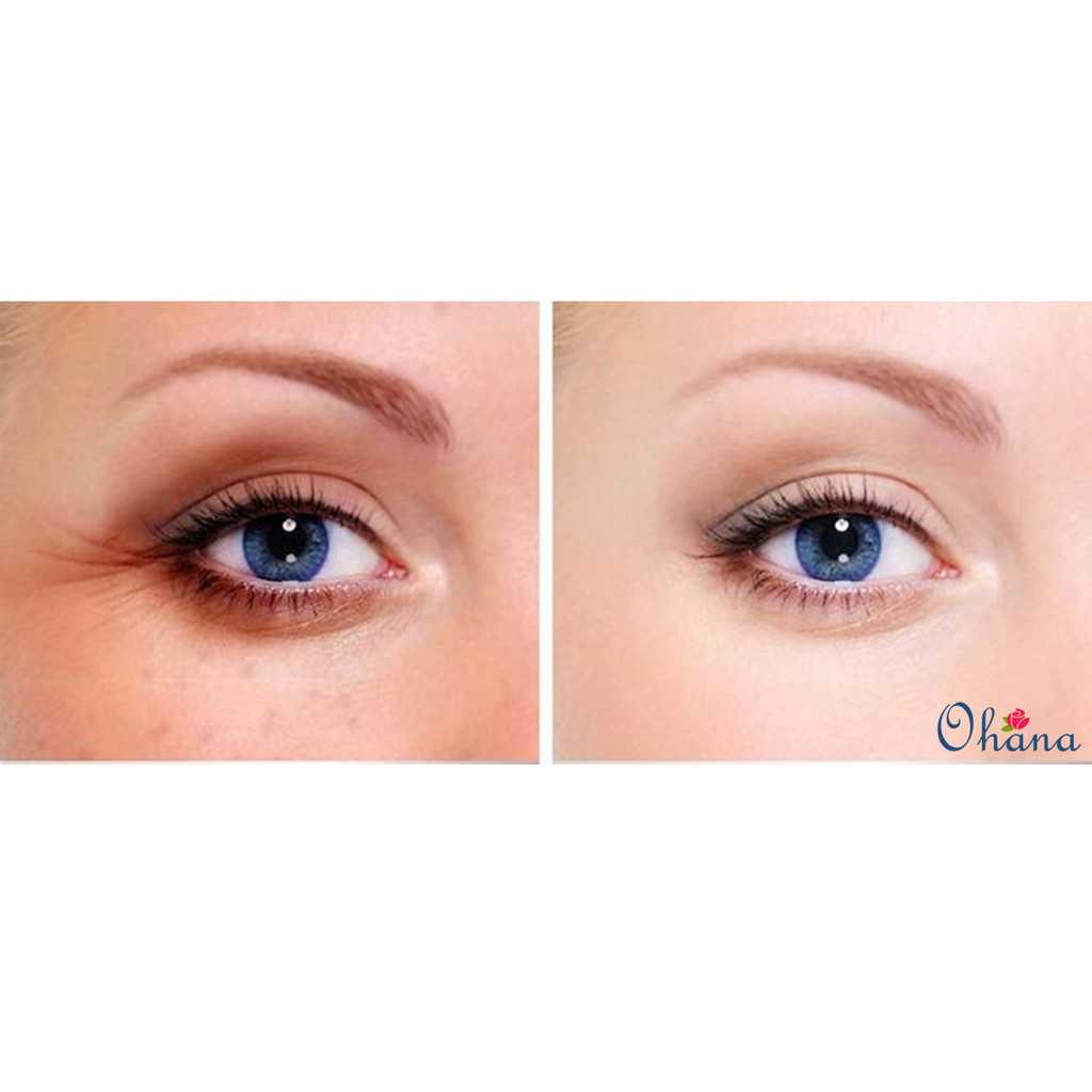 Dầu Dưỡng Giảm Quầng Thâm, Nếp Nhăn Balance Active Formula Dragon's Blood Eye Lift Balm 15ml | BigBuy360 - bigbuy360.vn