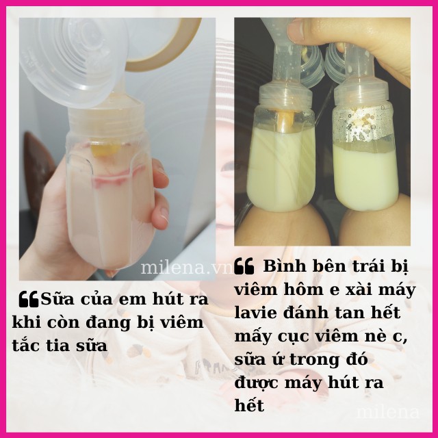 Máy thông tắc tia sữa Lavie tự làm dễ dàng hiệu quả tức thời an toàn ít đau ngừa tái phát hút sữa nhanh [chính hãng Mỹ]