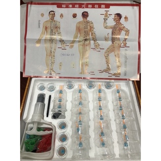 Bộ giác hơi không dùng lửa