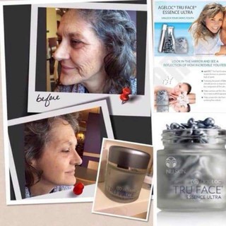 Trẻ hoá da TRUFACE ESSENCE ULTRA (NUSKIN)