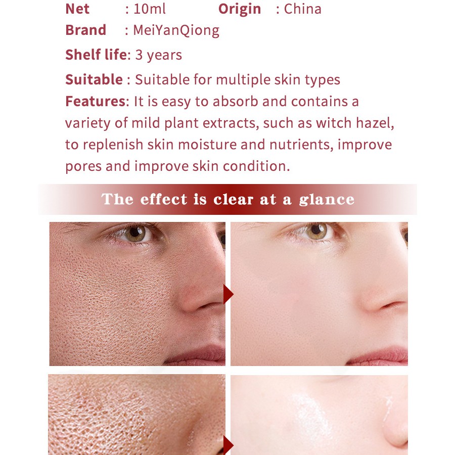 [Hàng Mới Về] MeiYanQiong Serum Cấp Nước Dưỡng Ẩm Thu Nhỏ Lỗ Chân Lông  Giảm Nếp Nhăn Dưỡng Trắng Căng Mịn Da 10ml