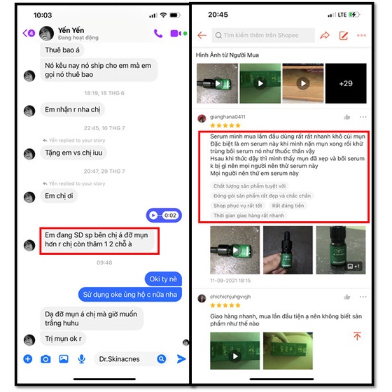 Serum mụn thảo dược Dr.Skin acnes, đánh bay mụn, sạch thâm trong 7 ngày | BigBuy360 - bigbuy360.vn