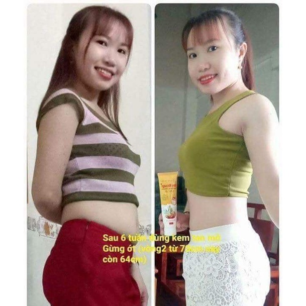 Kem tan mỡ Ngân Bình làm giảm mỡ bụng sau sinh, mỡ đùi, bắp tay, mỡ thừa trên cơ thể nhanh chóng, da săn chắc