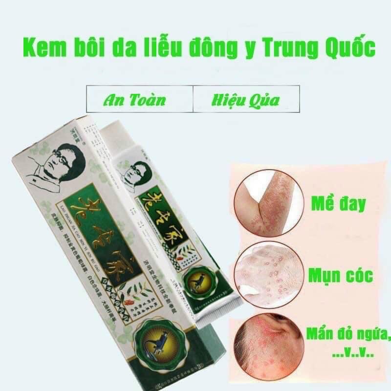 KEM BÔI NỨT NẺ CHÂN TAY THẦN THÁNH ( tuýp xanh )