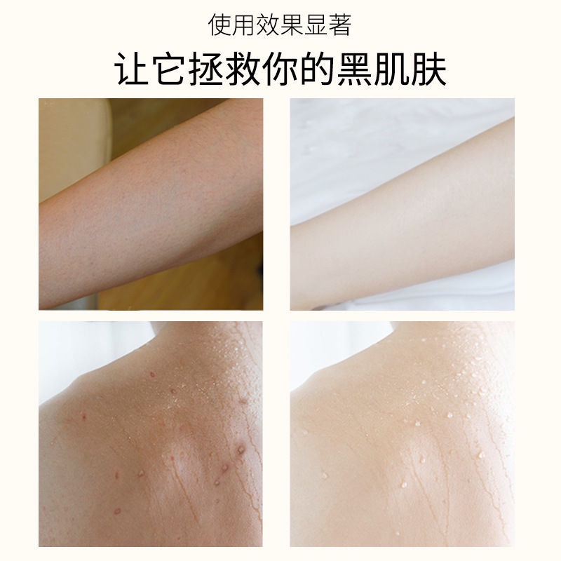 Gel Tắm 300g Loại Bỏ Melanin Làm Trắng Da Dành Cho Nam Và Nữ