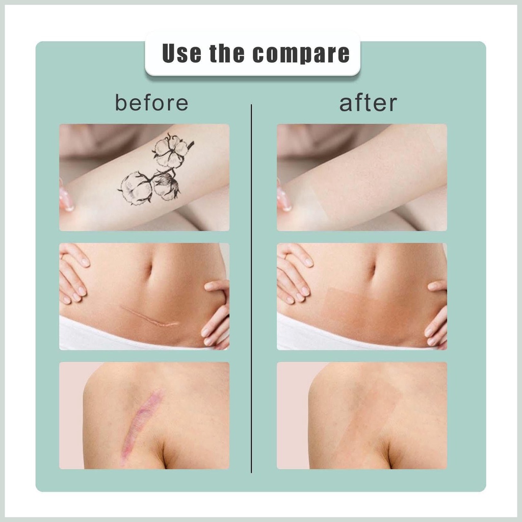 Miếng Dán Hình Xăm Che Khuyết Điểm Chống Thấm Nước Thoáng Khí Cho kiodvn