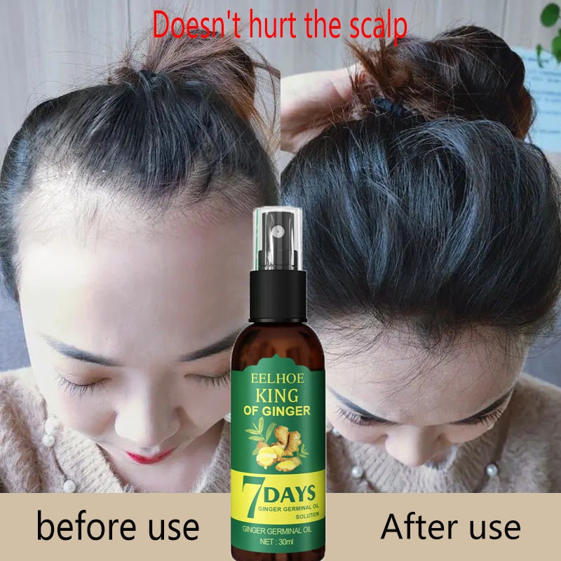 Tinh Dầu Gừng Kích Thích Mọc Tóc Cho Nam Và Nữ