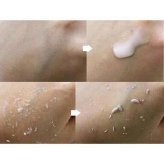 Tẩy da chết Ecosy Hàn Quốc 180ml