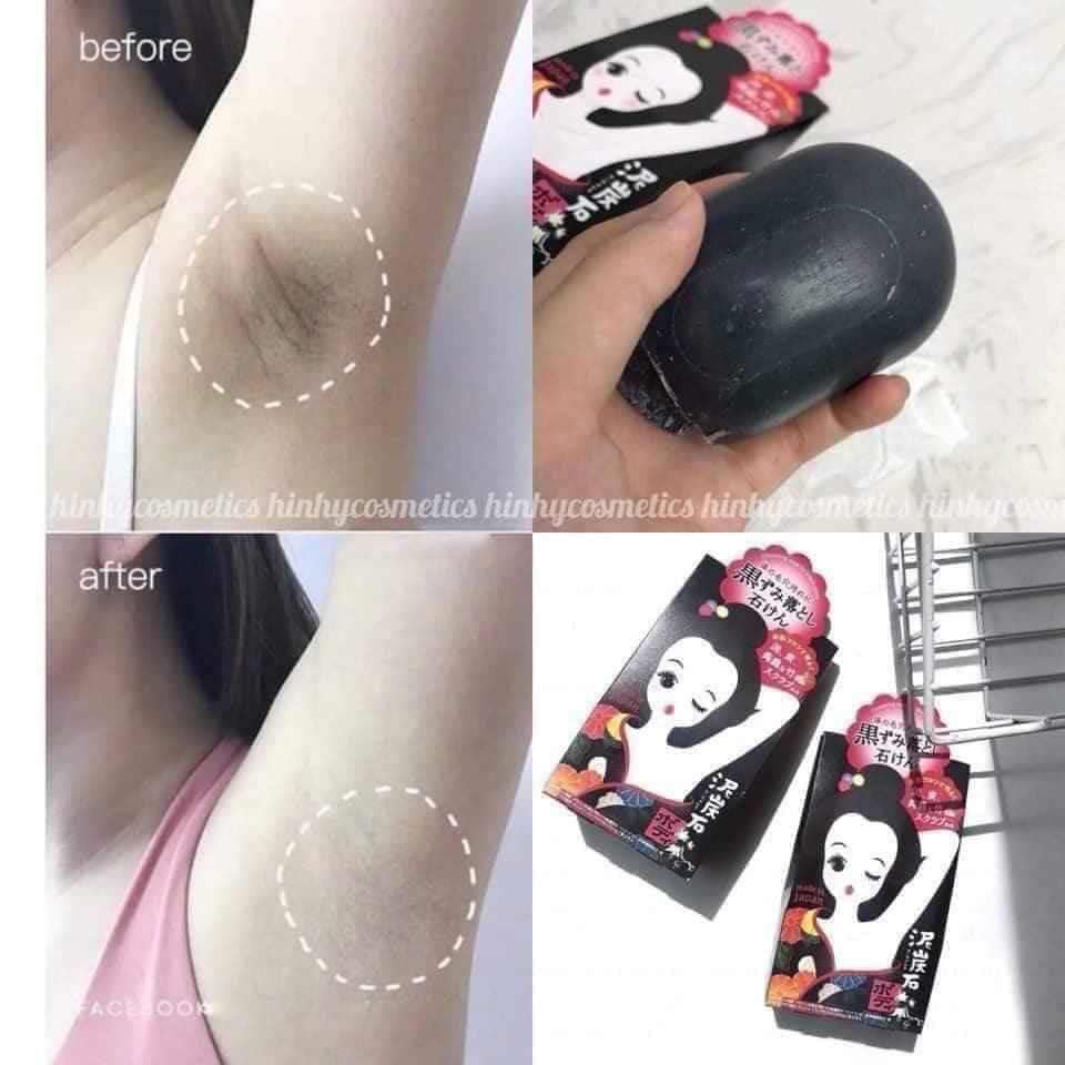 Xà Phòng Loại Bỏ Thâm Nách Pelican | BigBuy360 - bigbuy360.vn