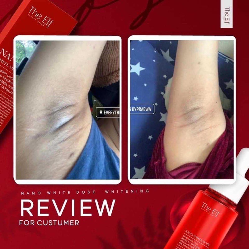 Serum truyền trắng mờ thâm sẹo The Elf Nano white dose Thái Land