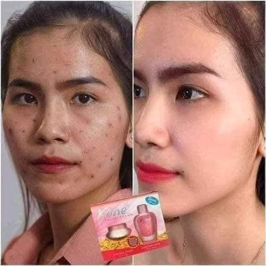 Kem KONE THÁI LAN MẪU MỚI 2021