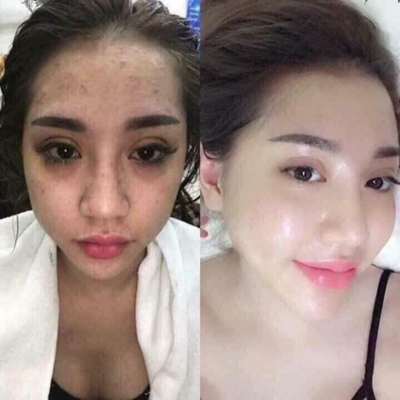 Combo ủ trắng kén tằm và kem face baby millk | BigBuy360 - bigbuy360.vn