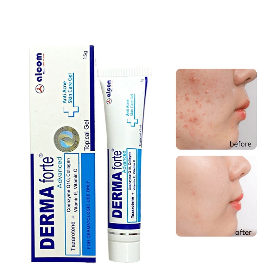 Gel Giảm Mụn, Thâm Sẹo Và Dưỡng Da Gamma Derma Forte Gel 15g - Bản Advance