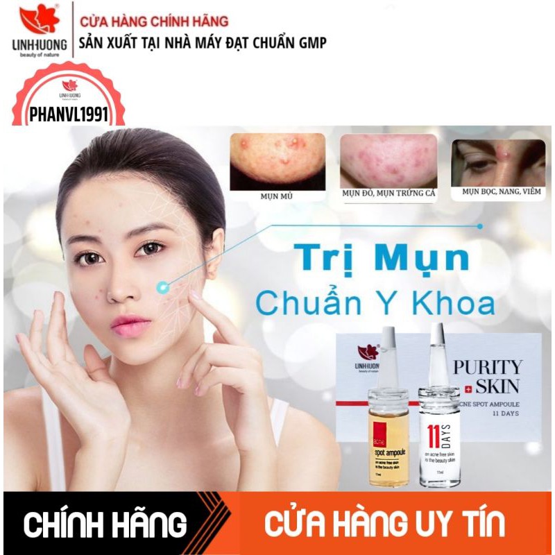 BỘ GIẢM MỤN, NGỪA MỤN, MỜ THÂM DA DẦU NHẠY CẢM[CHÍNH HÃNG]