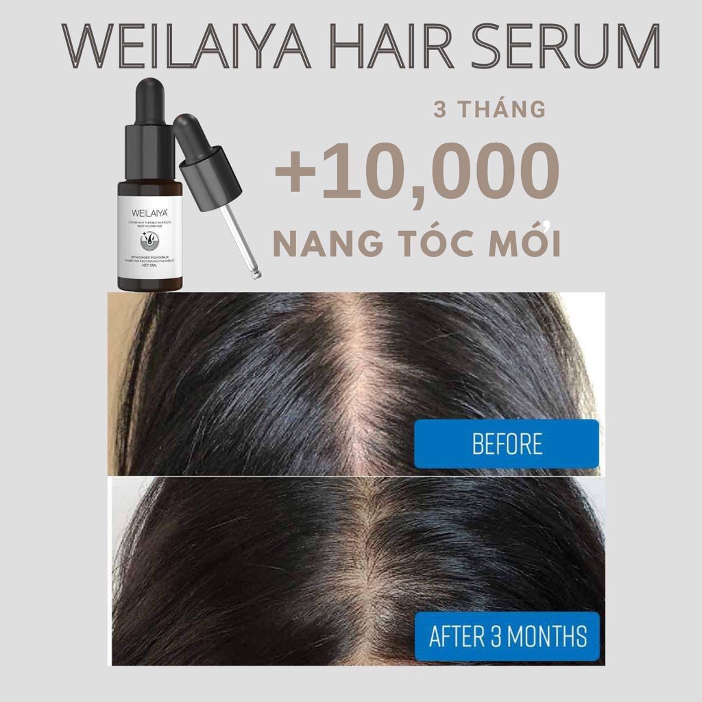 Huyết thanh WEILAIYA, Serum tóc Weilaiya Ginger Hair Root Nourishing Essence (5ml x 8 lọ)