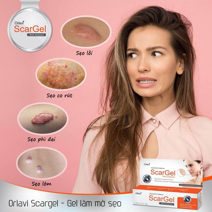 Kem Liền Sẹo Orlavi ScarGel Giúp Làm Mờ Các Loại Sẹo Phẫu Thuật, Tai Nạn, Mụn, Bỏng