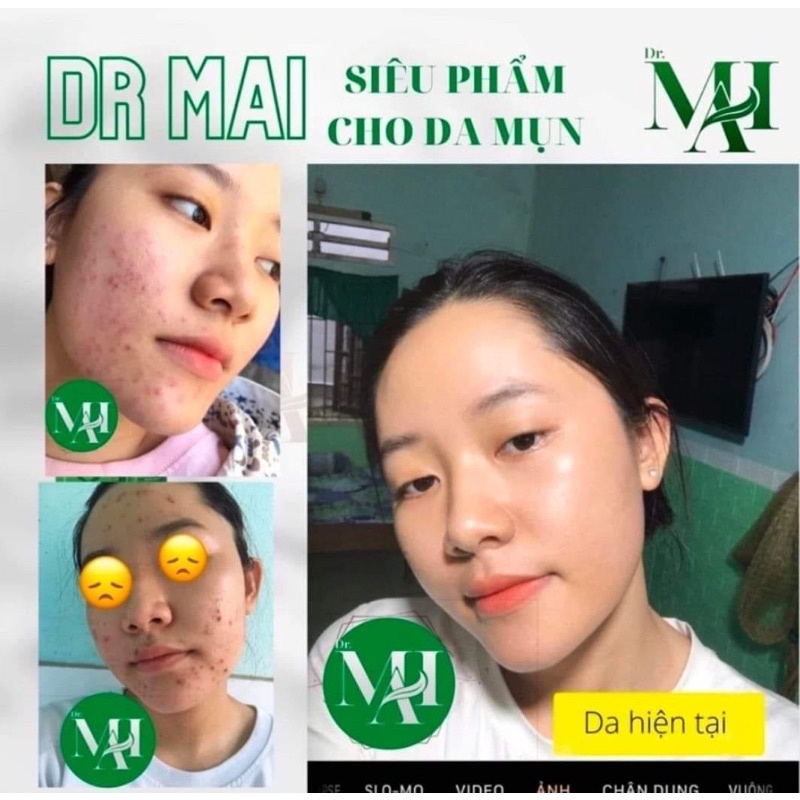 [Mẫu mới]Serum tri mụn dr mai xoá mụn giảm thâm