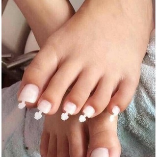 Móng úp chân fom ngắn