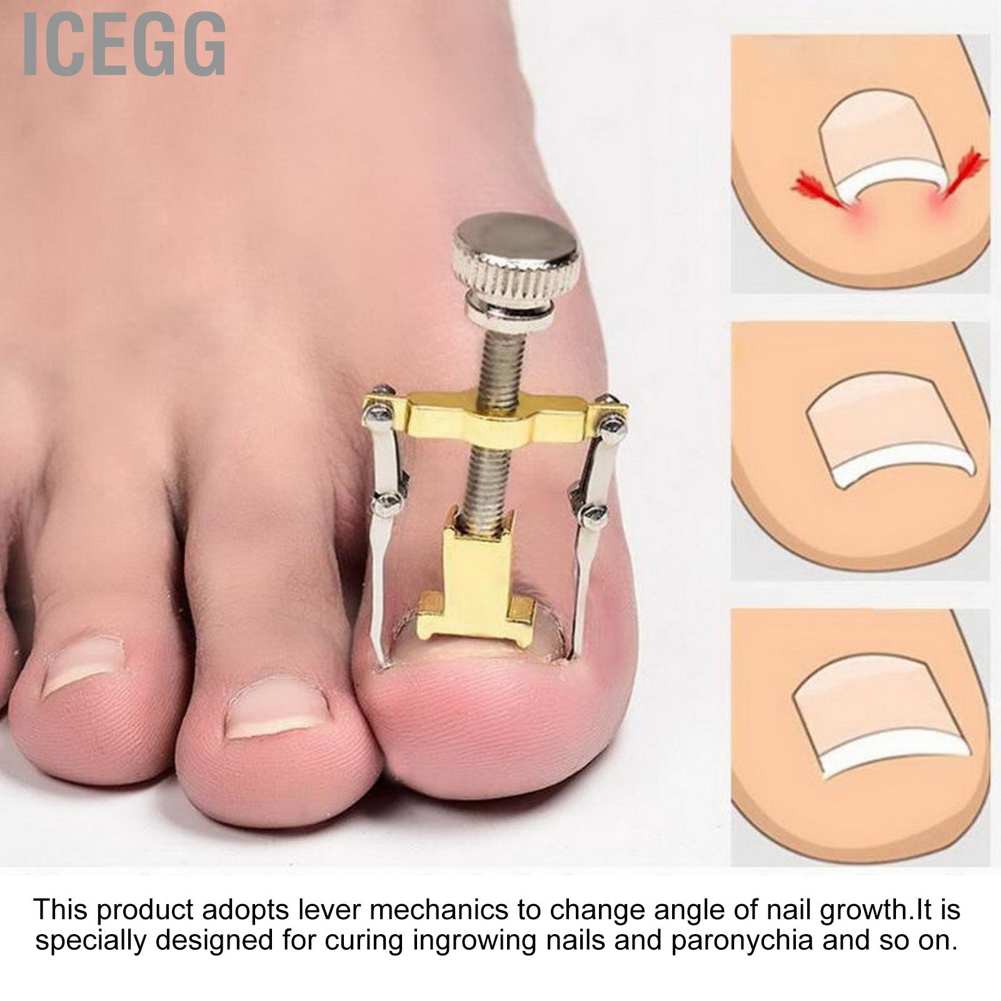 (Hàng Mới Về) Set 13 Dụng Cụ Chỉnh Hình Móng Chân Mọc Ngược Tiện Dụng | BigBuy360 - bigbuy360.vn